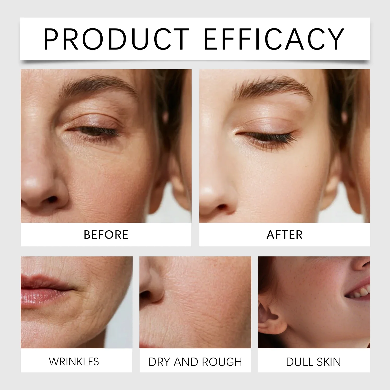 01Radiant Flawless Skin Micro Infusion Serum Kit - At Home Facial System Beauty Tool Skin Care for Face | 0.25MM Needle - Image 3